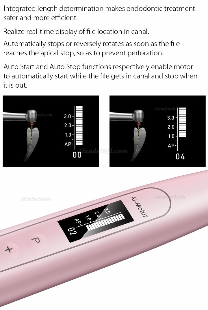 Woodpecker Ai-Motor Dental Endo Motor Apex Locator Brushless Cordless